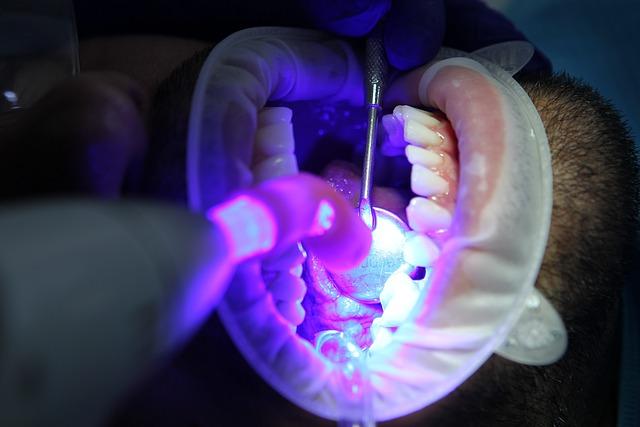 Arc Teeth Whitening Rinse: Unveiling the Results